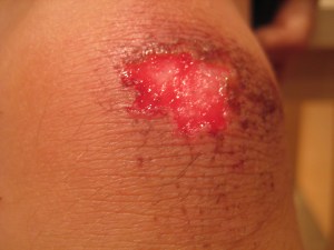 Pediiiihhhnyaaaaa...