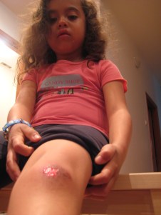 My little big girl with a big little boo-boo. 