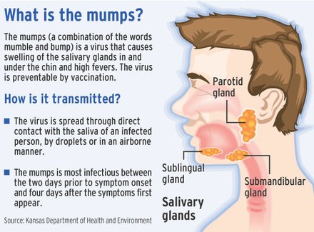 Mumps